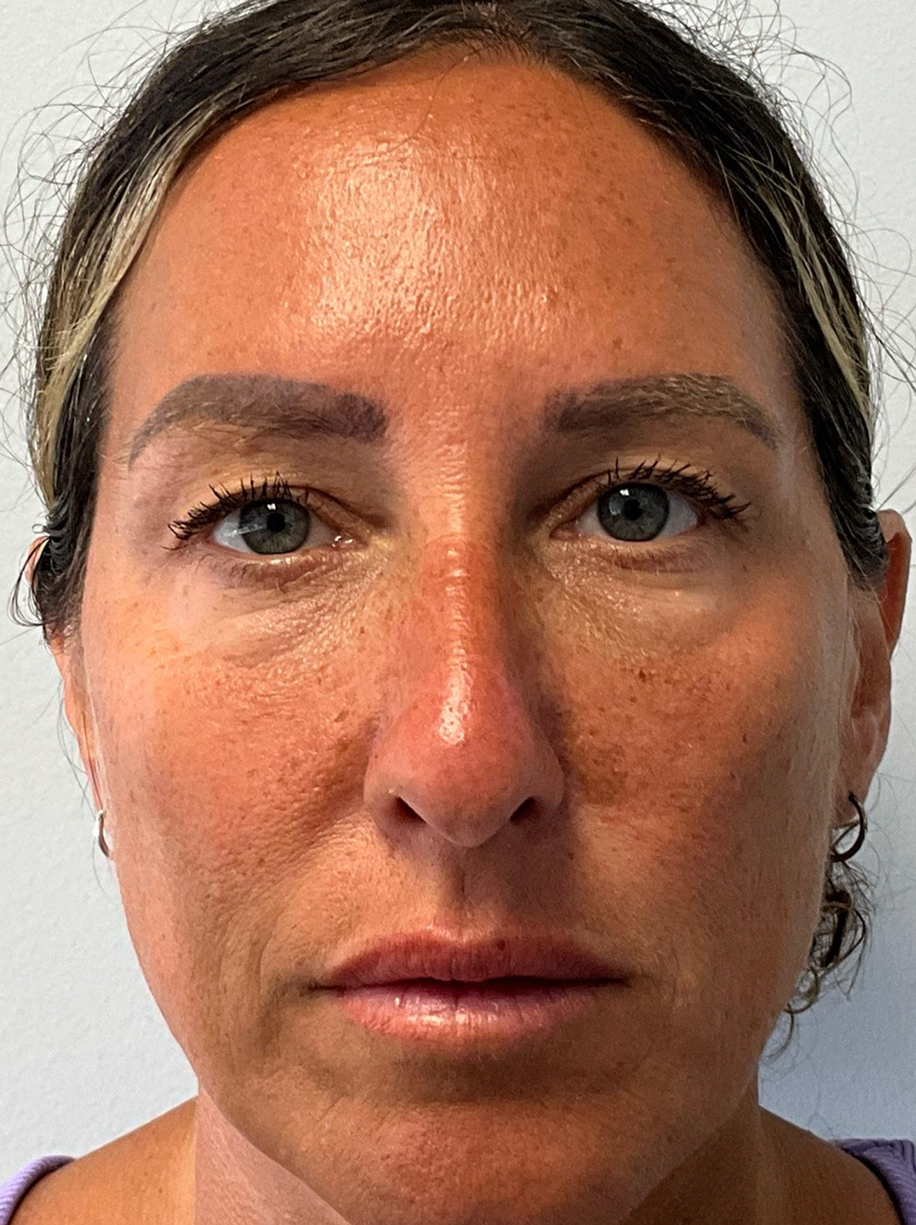 Allure Medical treatment imagery from Figma