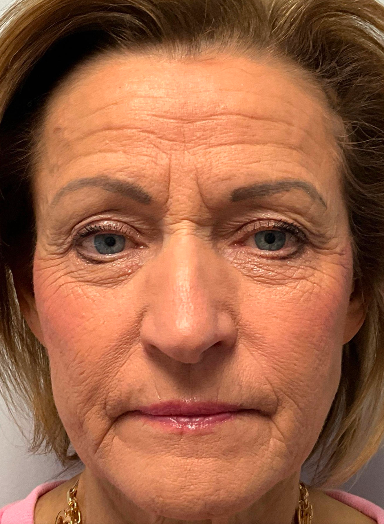 Allure Medical treatment imagery from Figma