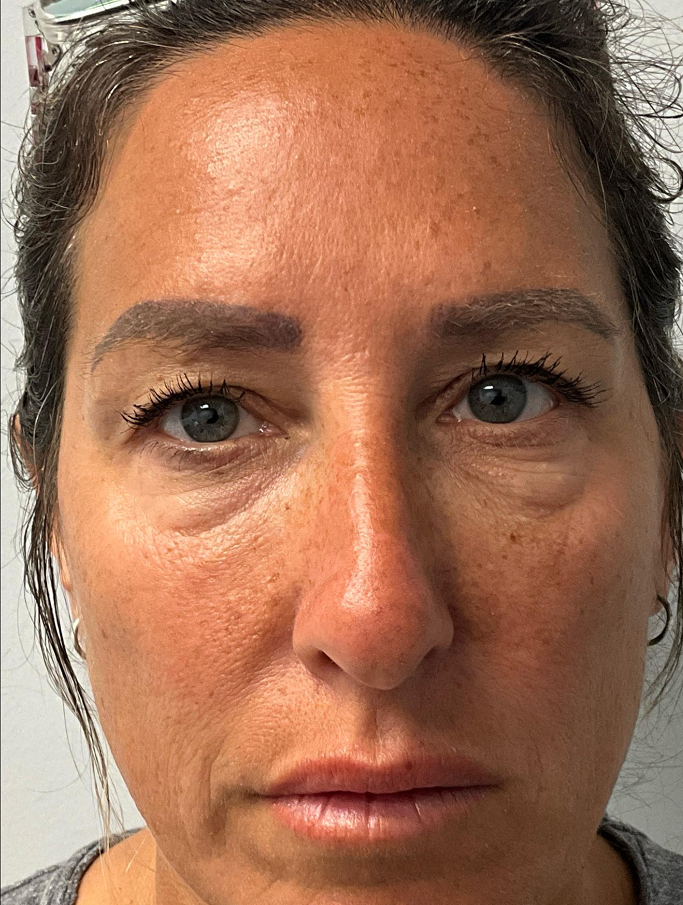 Allure Medical treatment imagery from Figma