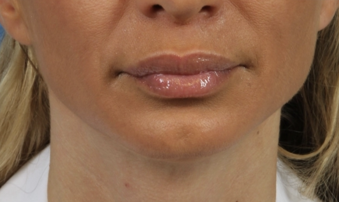 Allure Medical treatment imagery from Figma