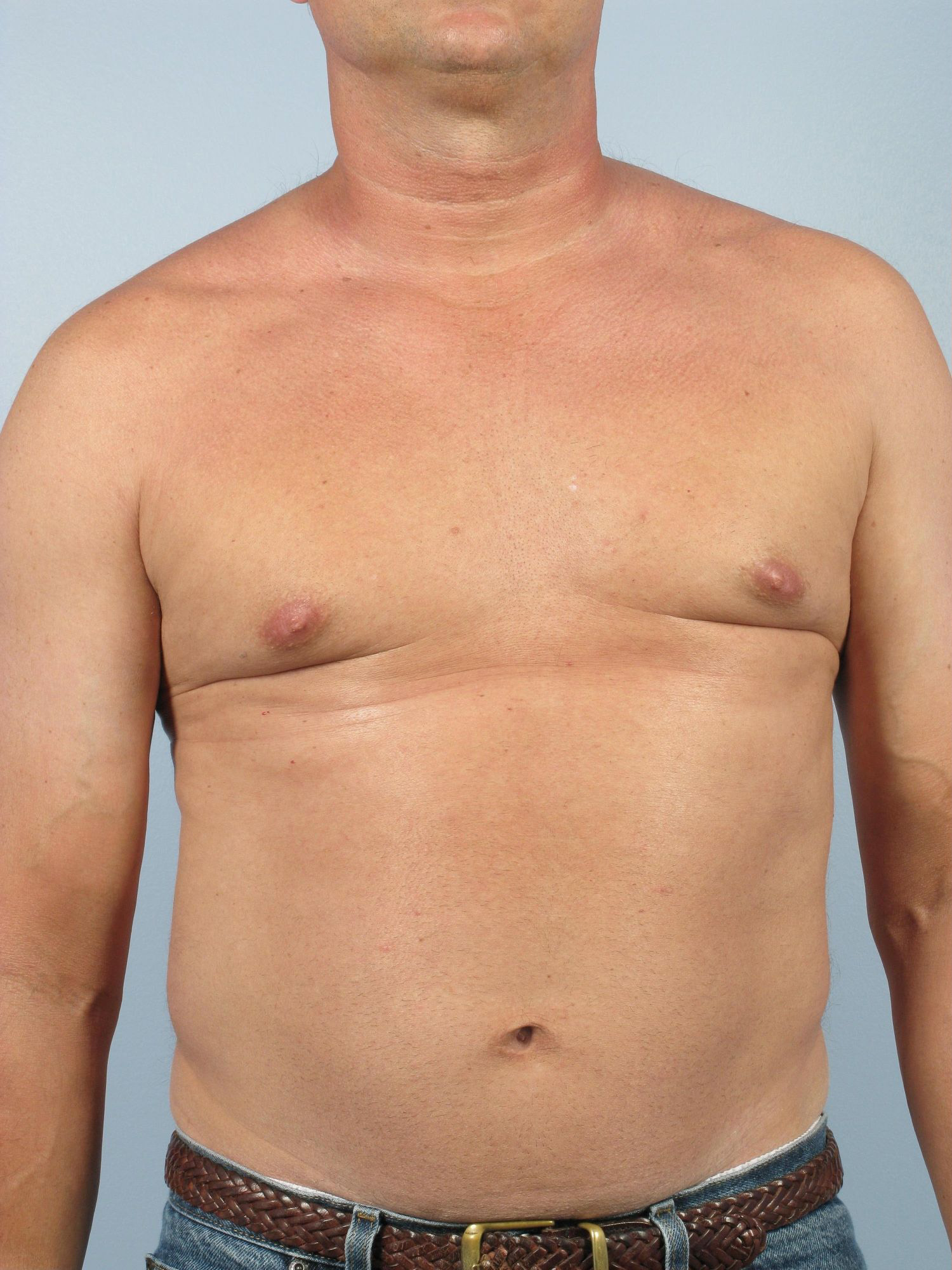 Allure Medical treatment imagery from Figma