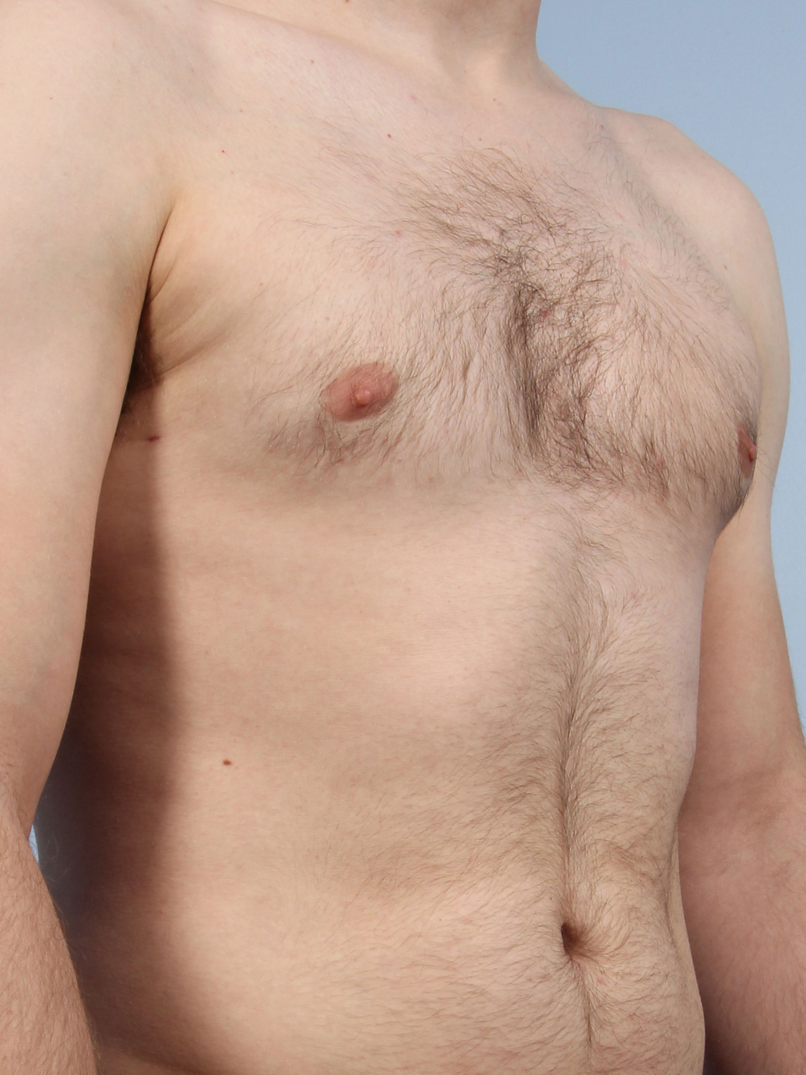 Allure Medical treatment imagery from Figma