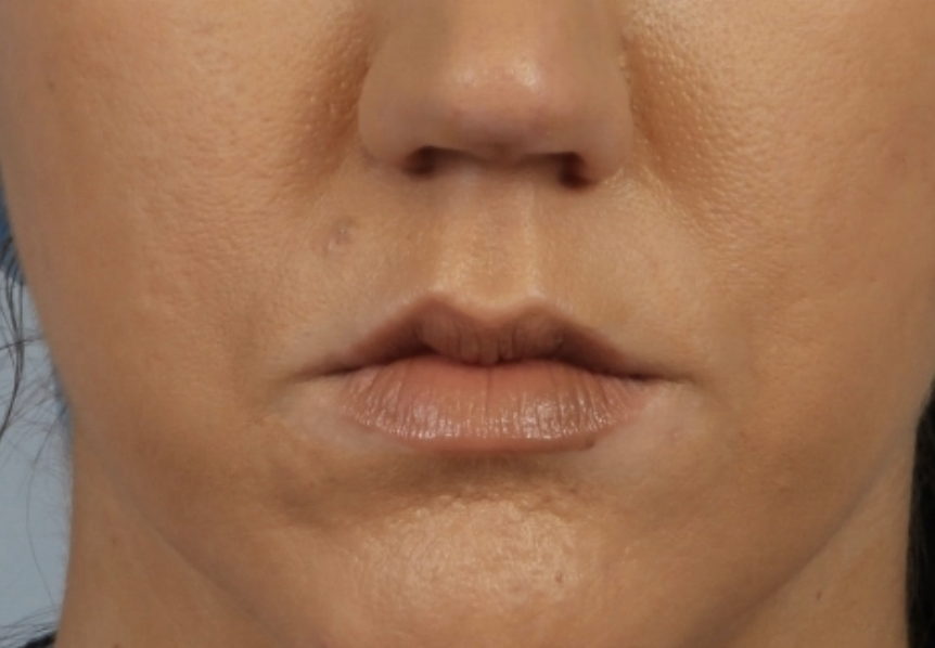 Allure Medical treatment imagery from Figma