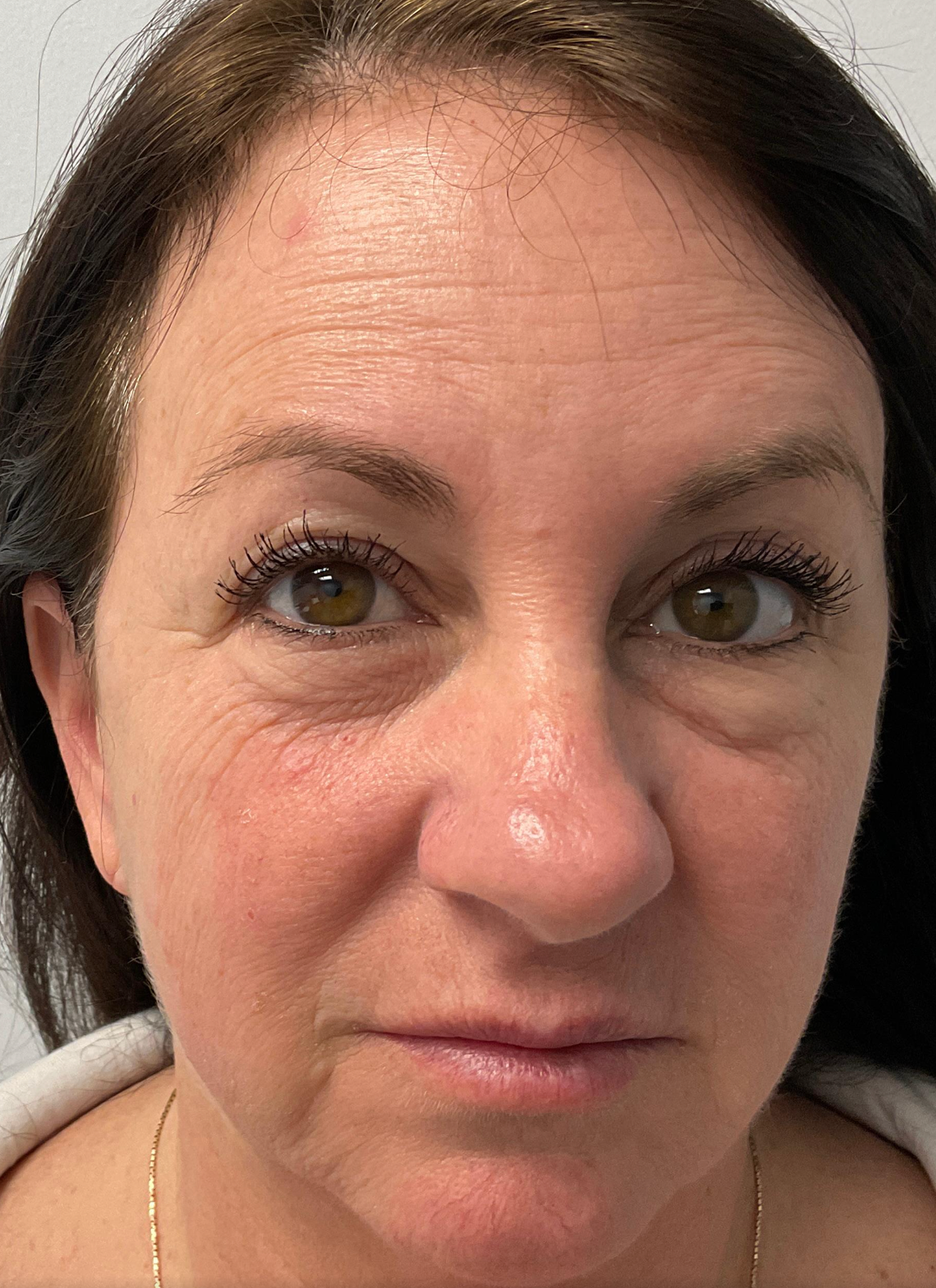 Allure Medical treatment imagery from Figma