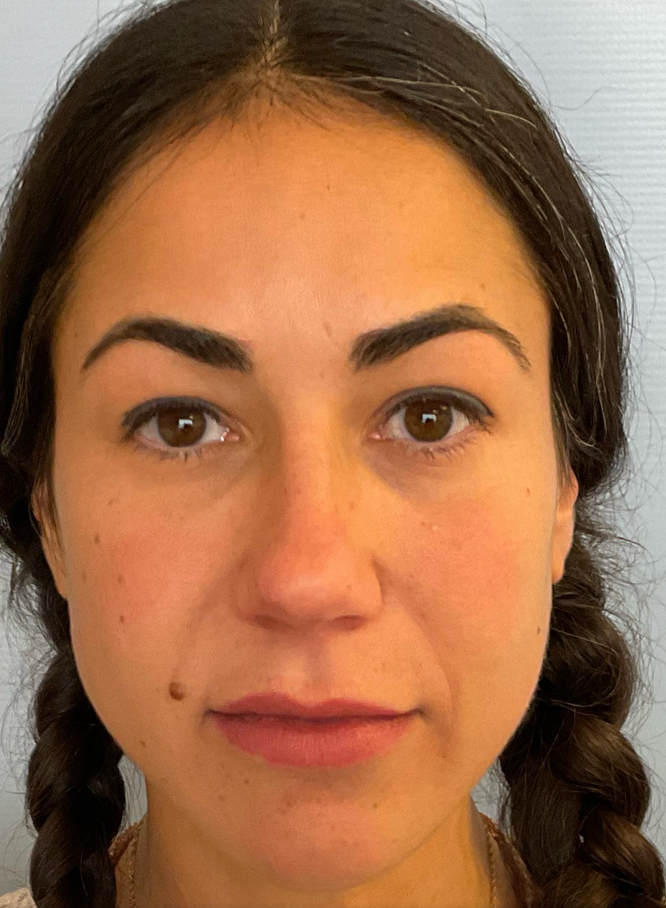 Allure Medical treatment imagery from Figma