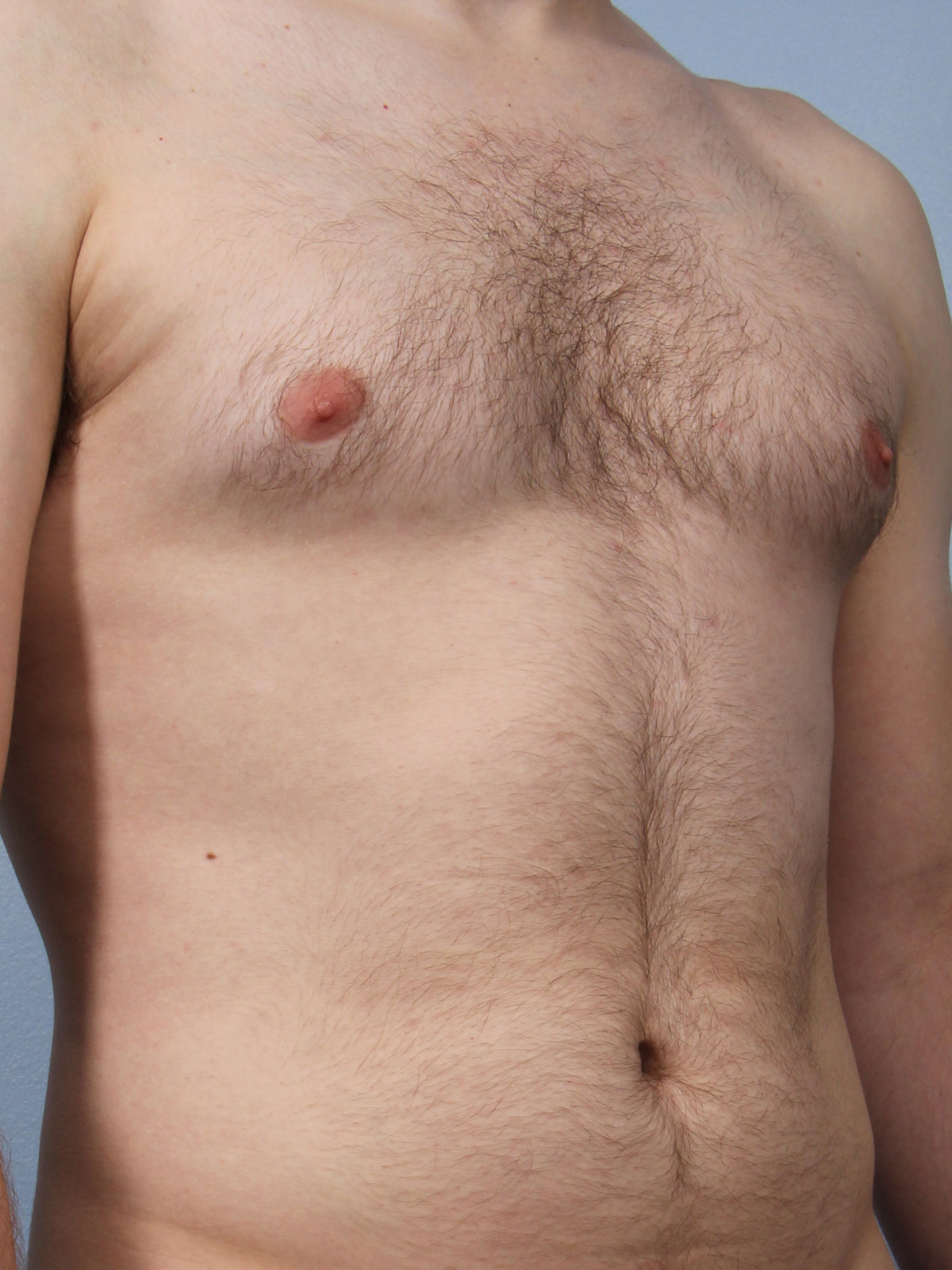 Allure Medical treatment imagery from Figma