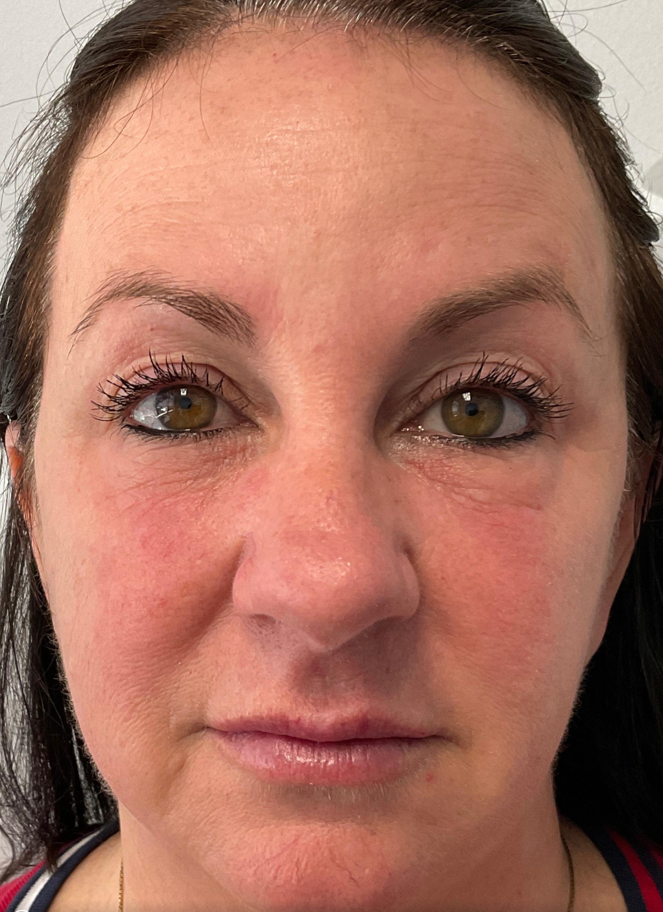 Allure Medical treatment imagery from Figma