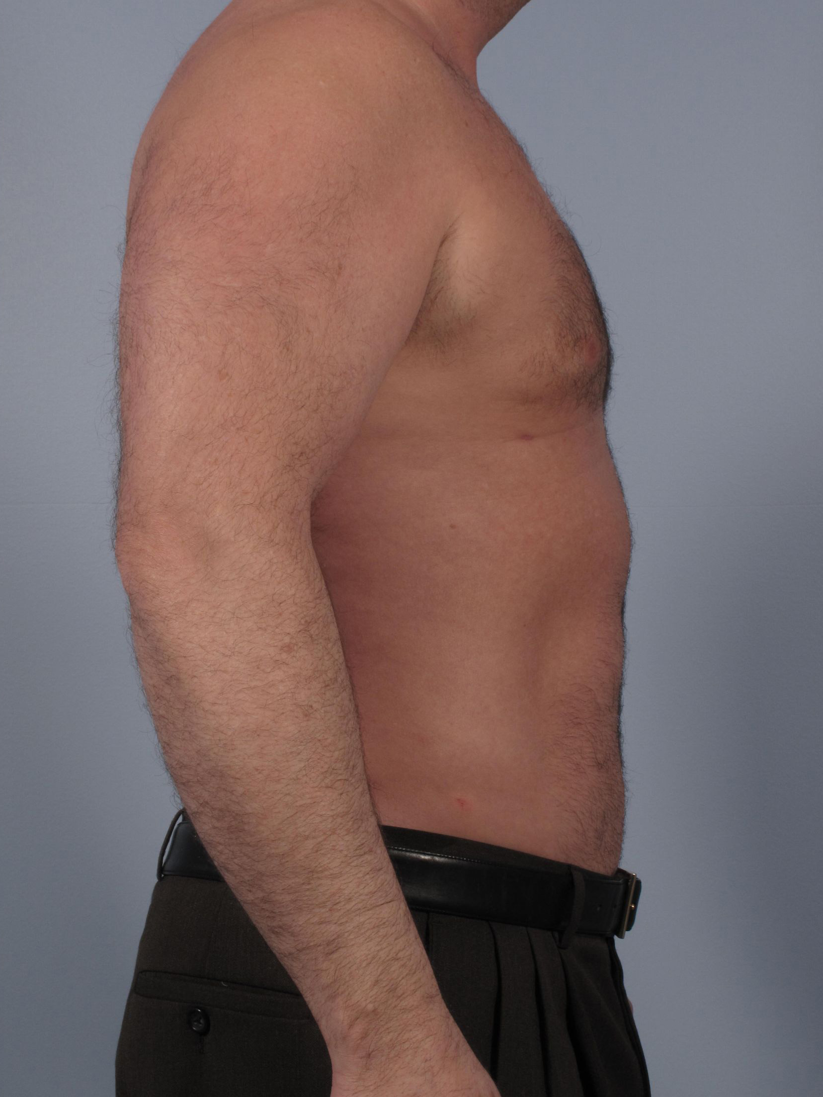Allure Medical treatment imagery from Figma
