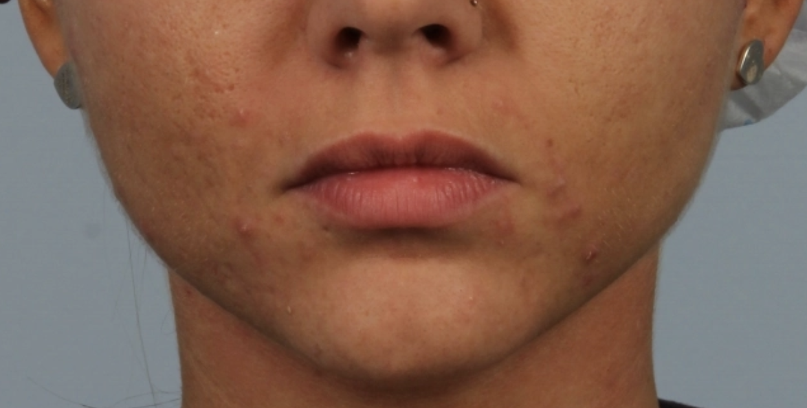 Allure Medical treatment imagery from Figma
