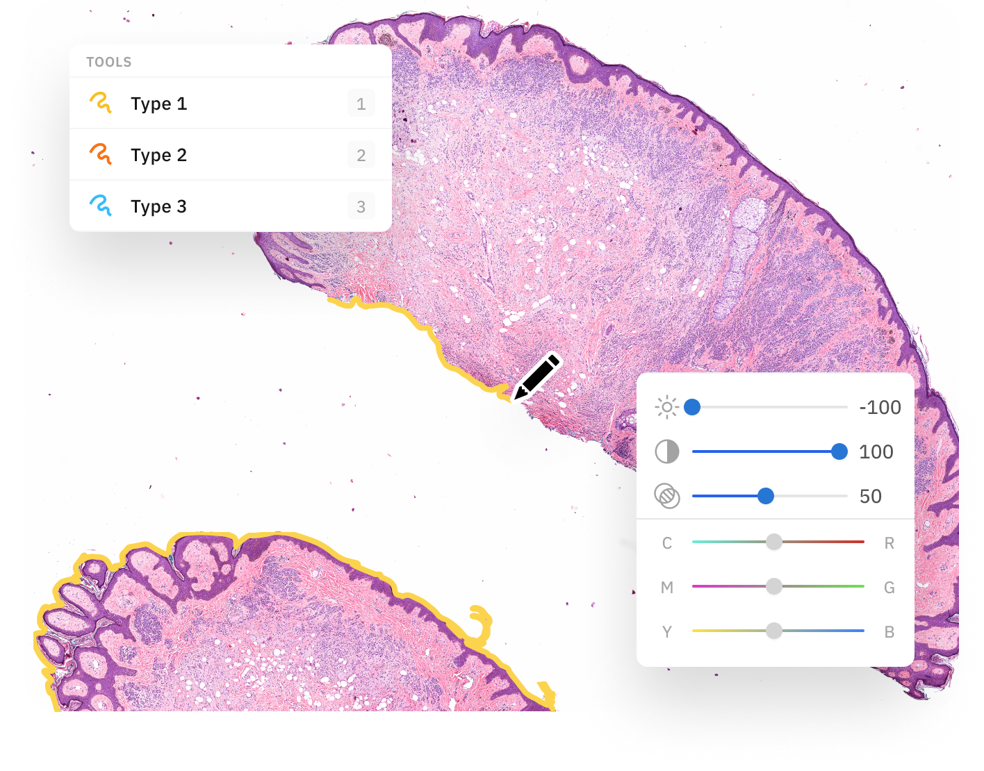 Annotate medical imagery pathology scans 