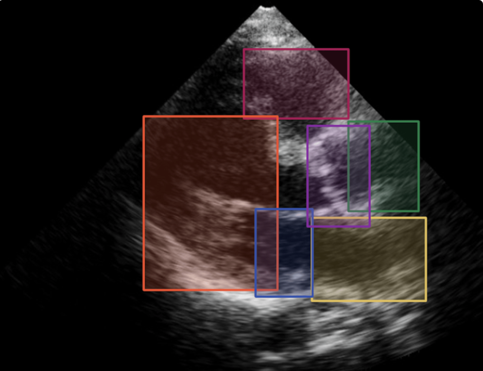 ultrasound-pic