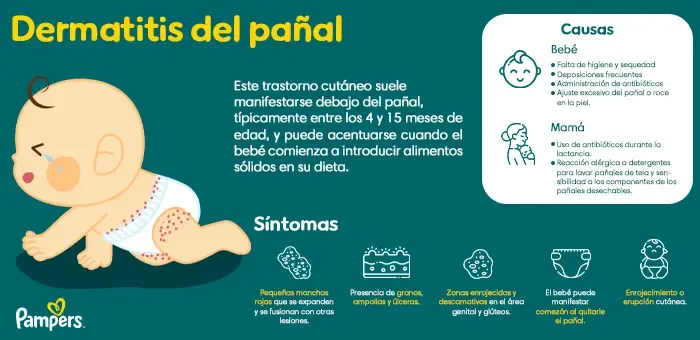 Causas de la dermatitis del pañal