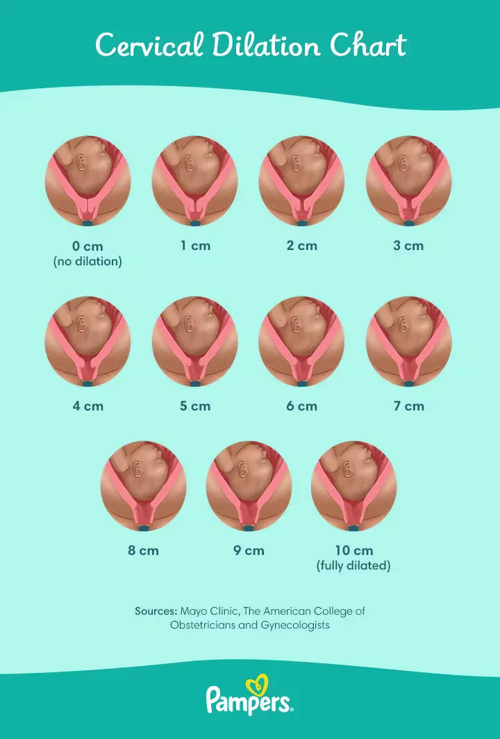 Pampers CervixDilation