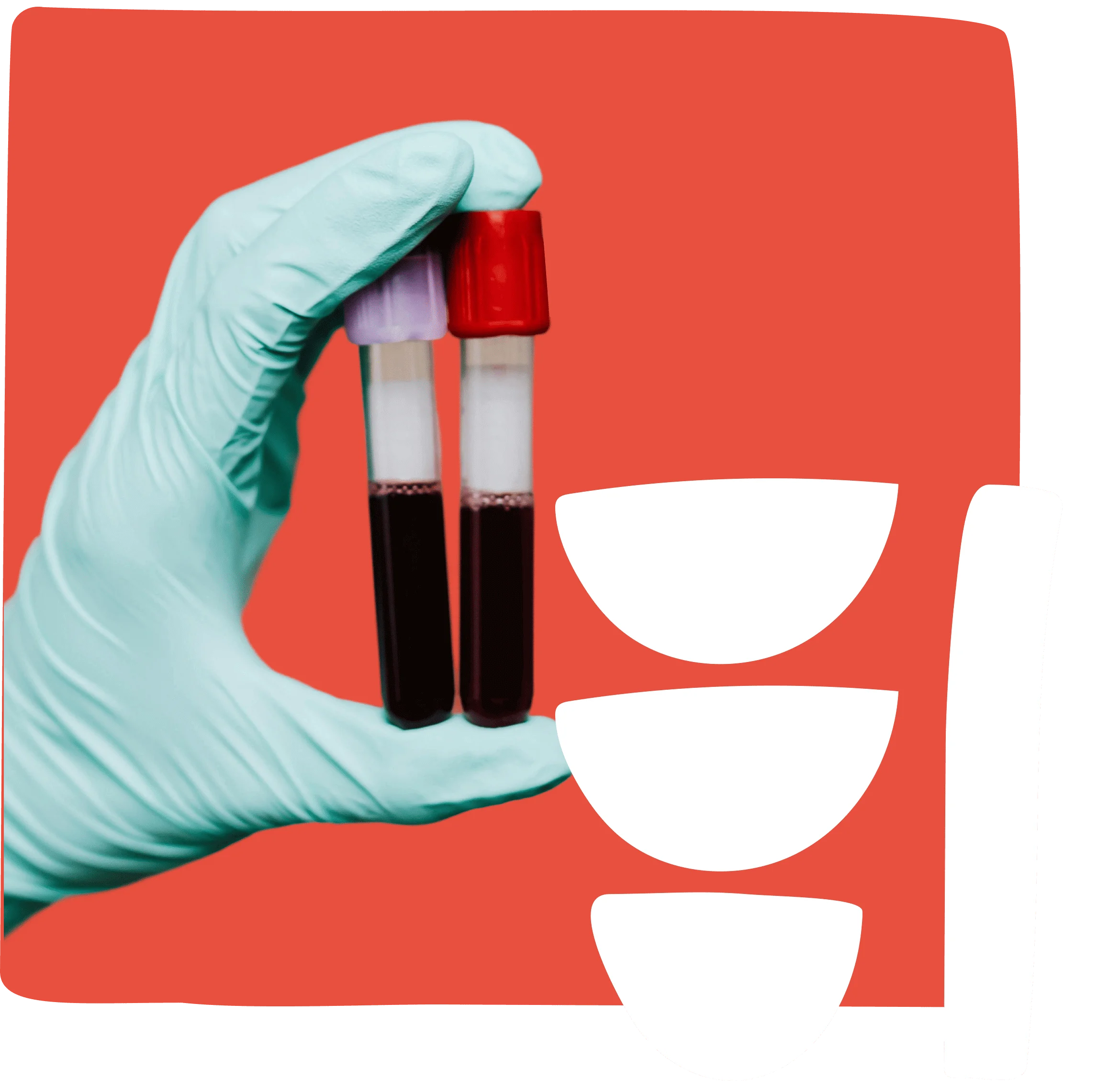 Ampath lab processes blood samples booked via Unu Health app.