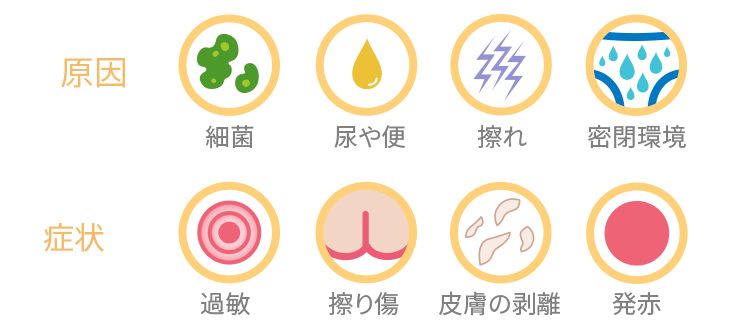 おむつによる吹き出物の手引き - Image 2 - Johnson's Baby - ja-JP