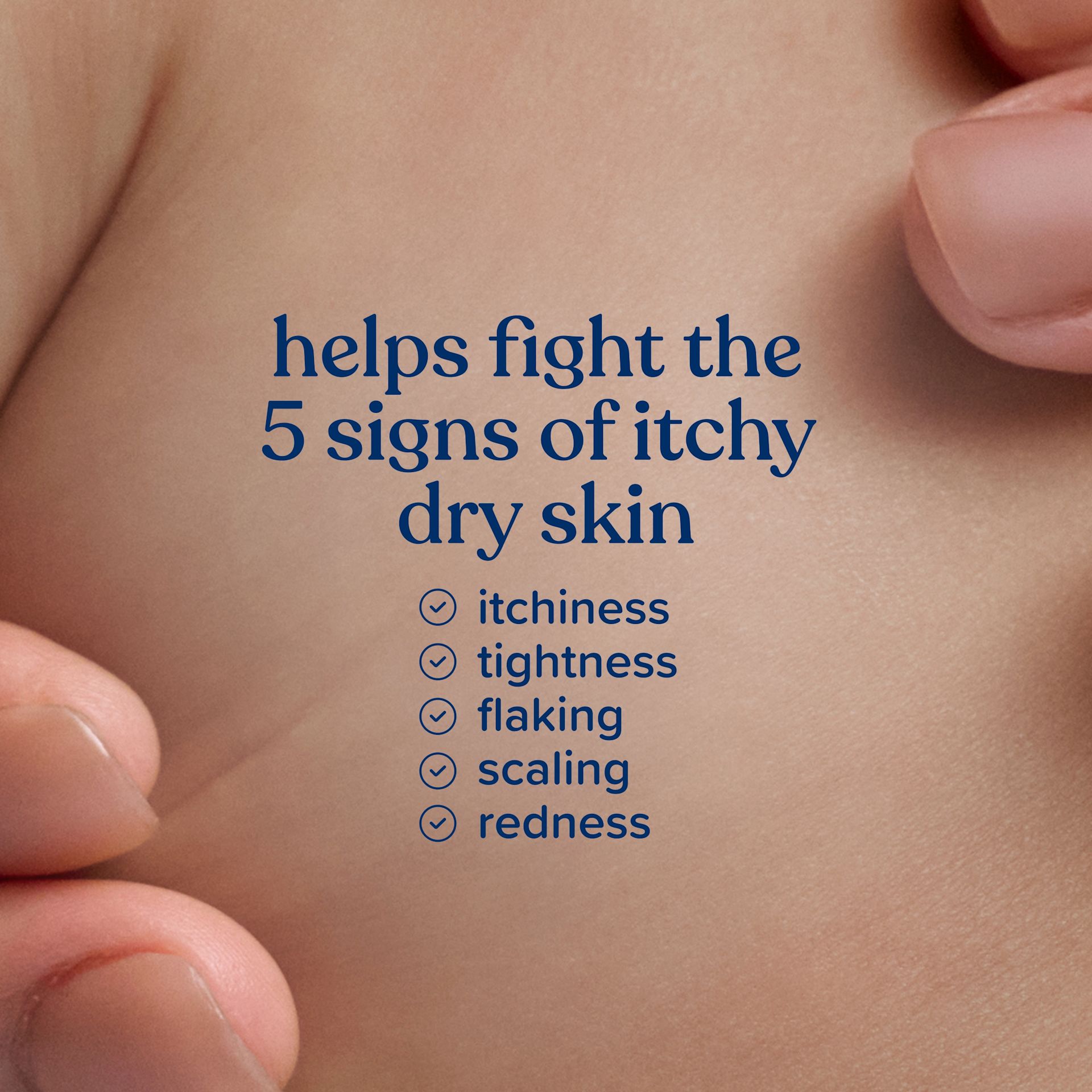 JOHNSON'S® Baby Lotion, helps fight the 5 signs of itchy dry skin
