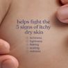 JOHNSON'S® Baby Lotion, helps fight the 5 signs of itchy dry skin