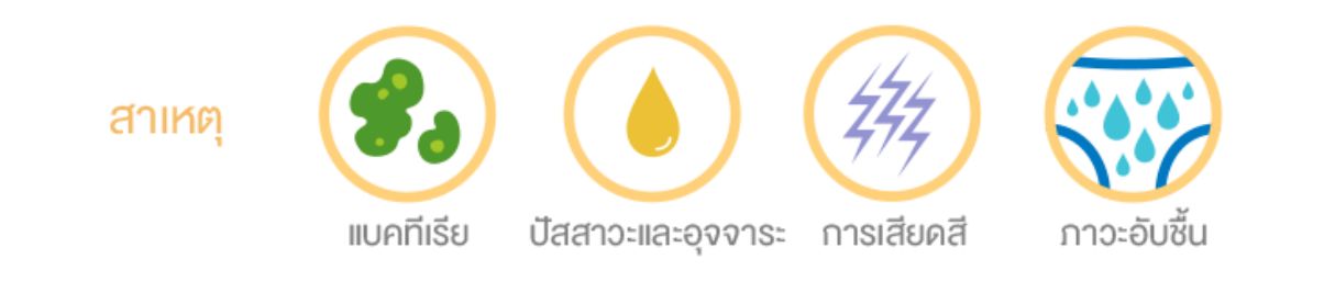 https://www.johnsonsbaby.co.th/sites/jbaby_th/files/diaper-rash-guide-1.png