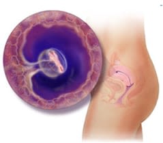 pregnancy-week-5-zh-hant-hk
