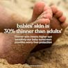Babies skin is 30% thinner than adults, higher sun sensitivity