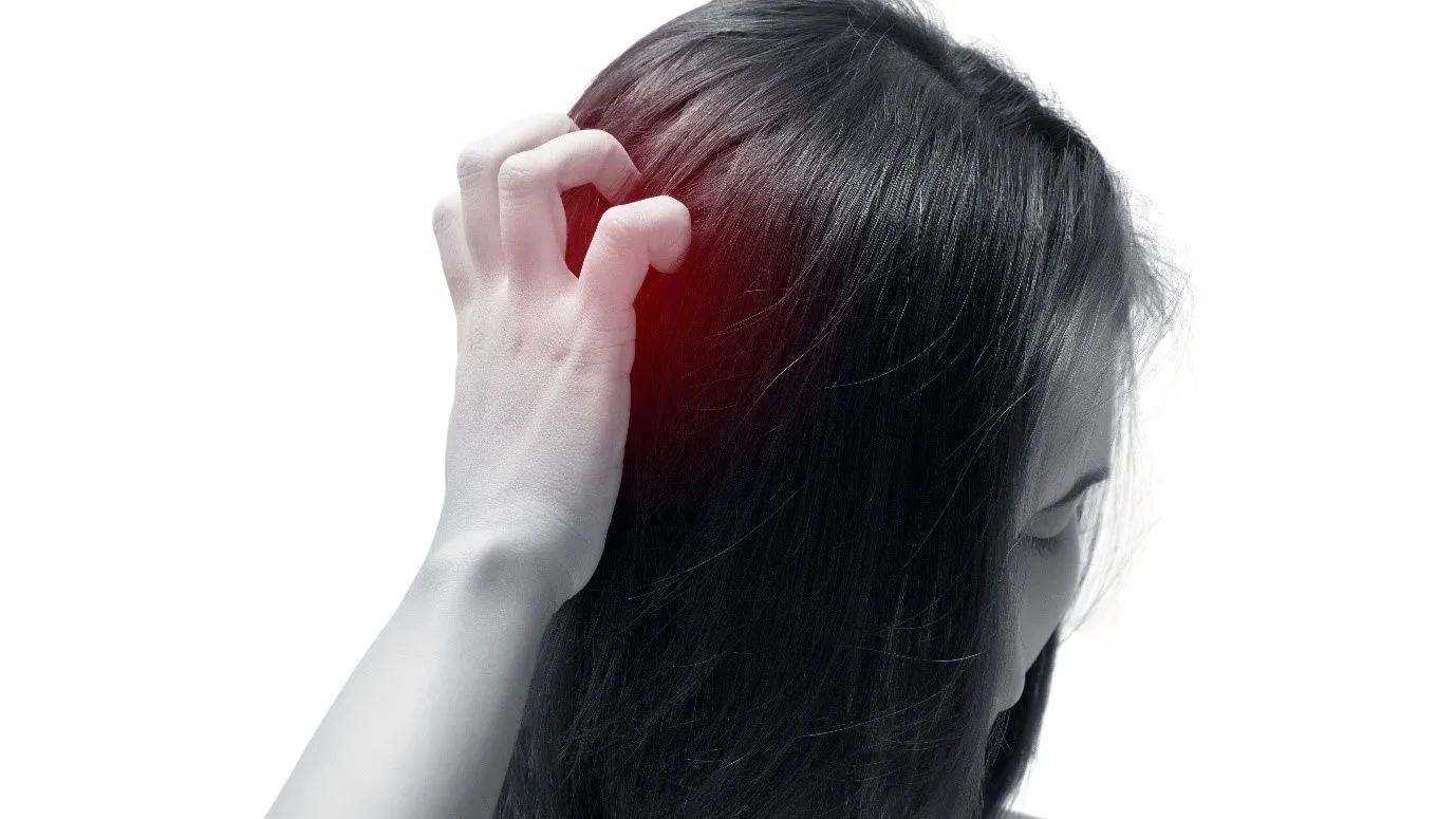 Scalp Pain: Causes and Solutions for Relief