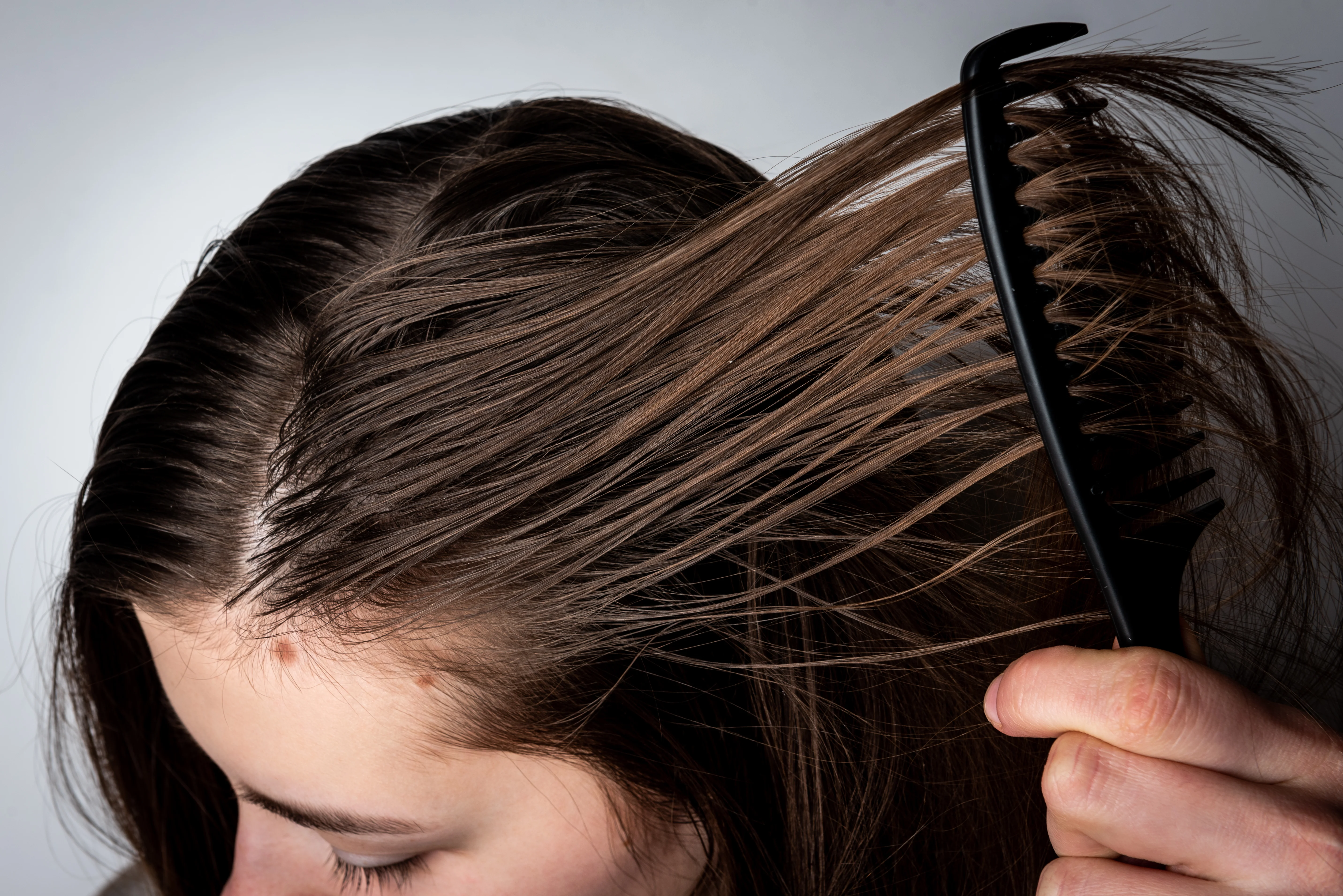 What is greasy hair and what causes it? | Head & Shoulders IN