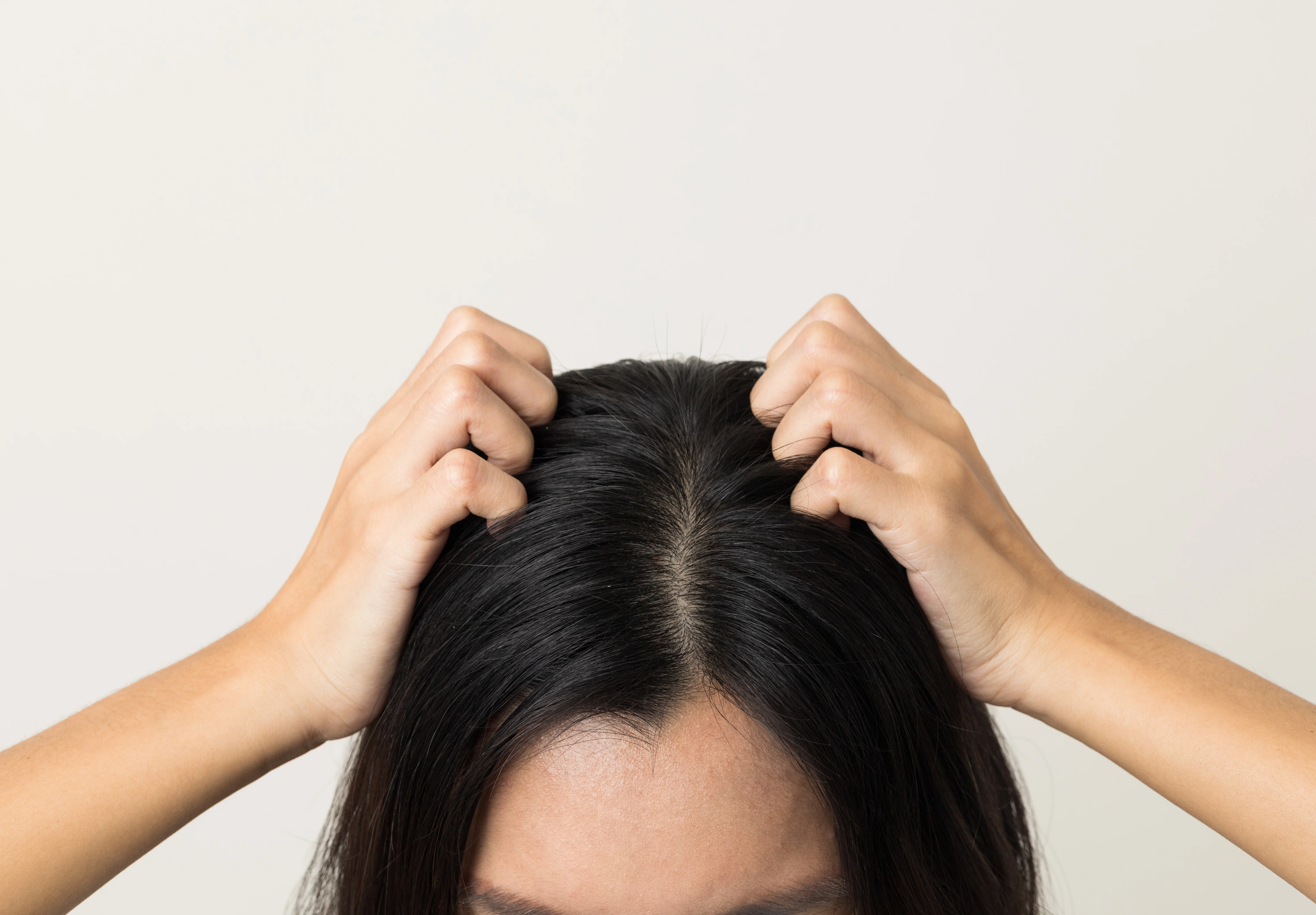 Diet to Reduce Scalp Itch