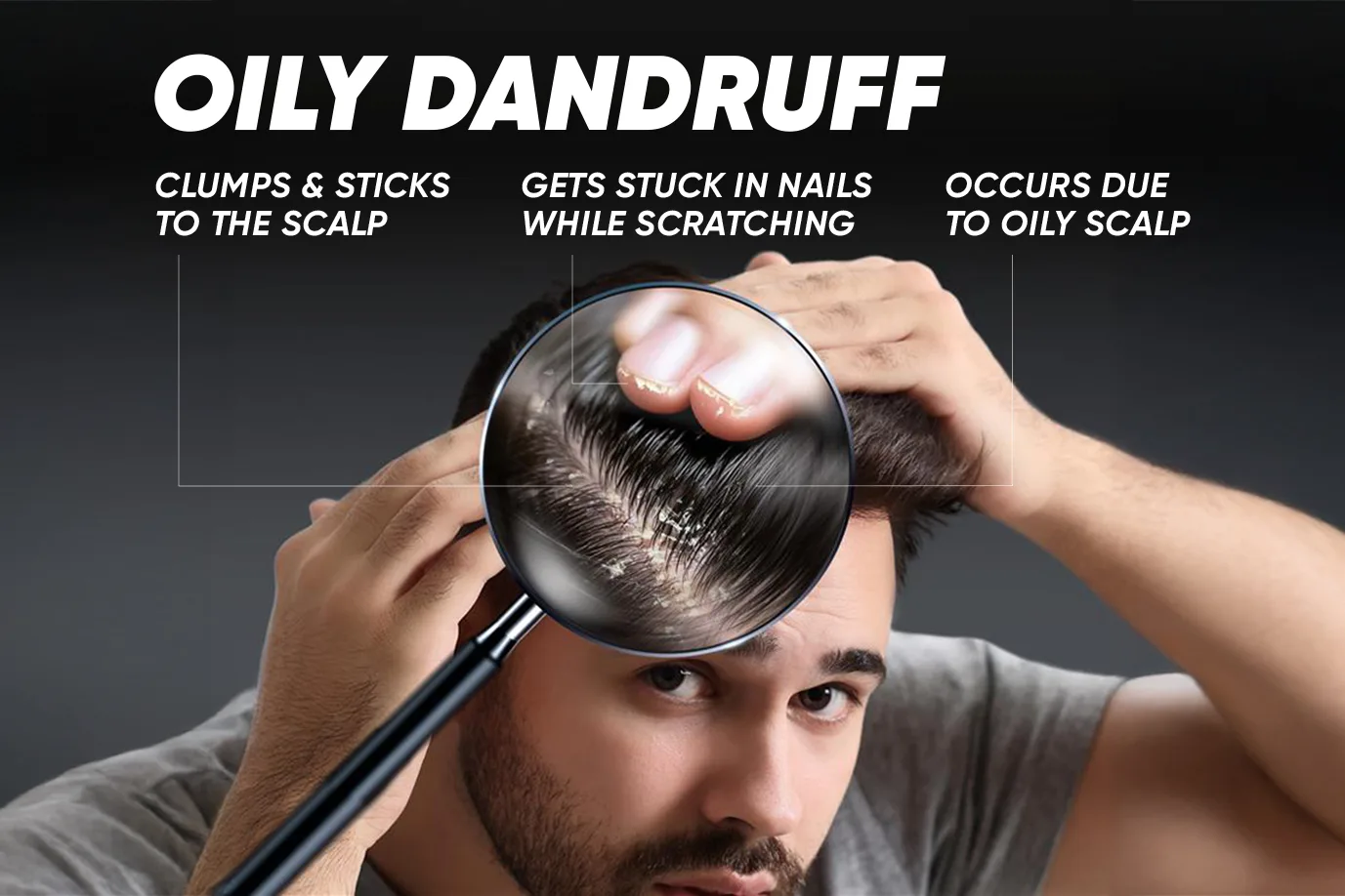 Image of a person with an oily scalp and visible dandruff flakes
