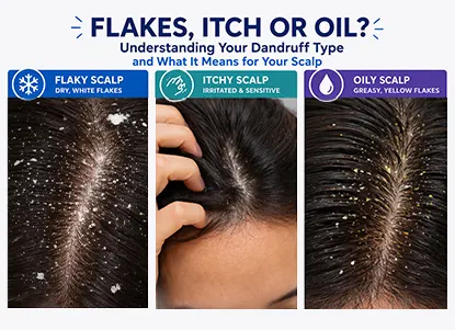 Flakes, itchy scalp or excess oil indicate different dandruff types that require targeted care for effective scalp treatment
