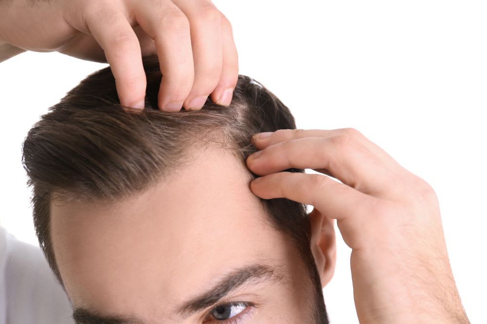 Dandruff on Bald Head - Tips and Advices Head & Shoulders IN