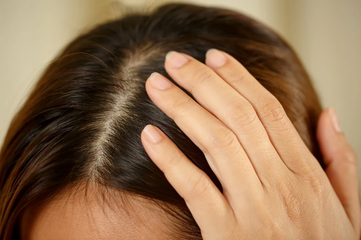 Woman with dry scalp
