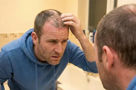 A visual showing stress and lack of sleep linked to an irritated, flaky scalp.