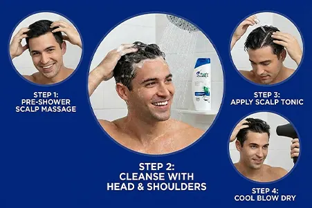 A routine-focused visual showing daily scalp care steps for maintaining a healthy, flake-free scalp.