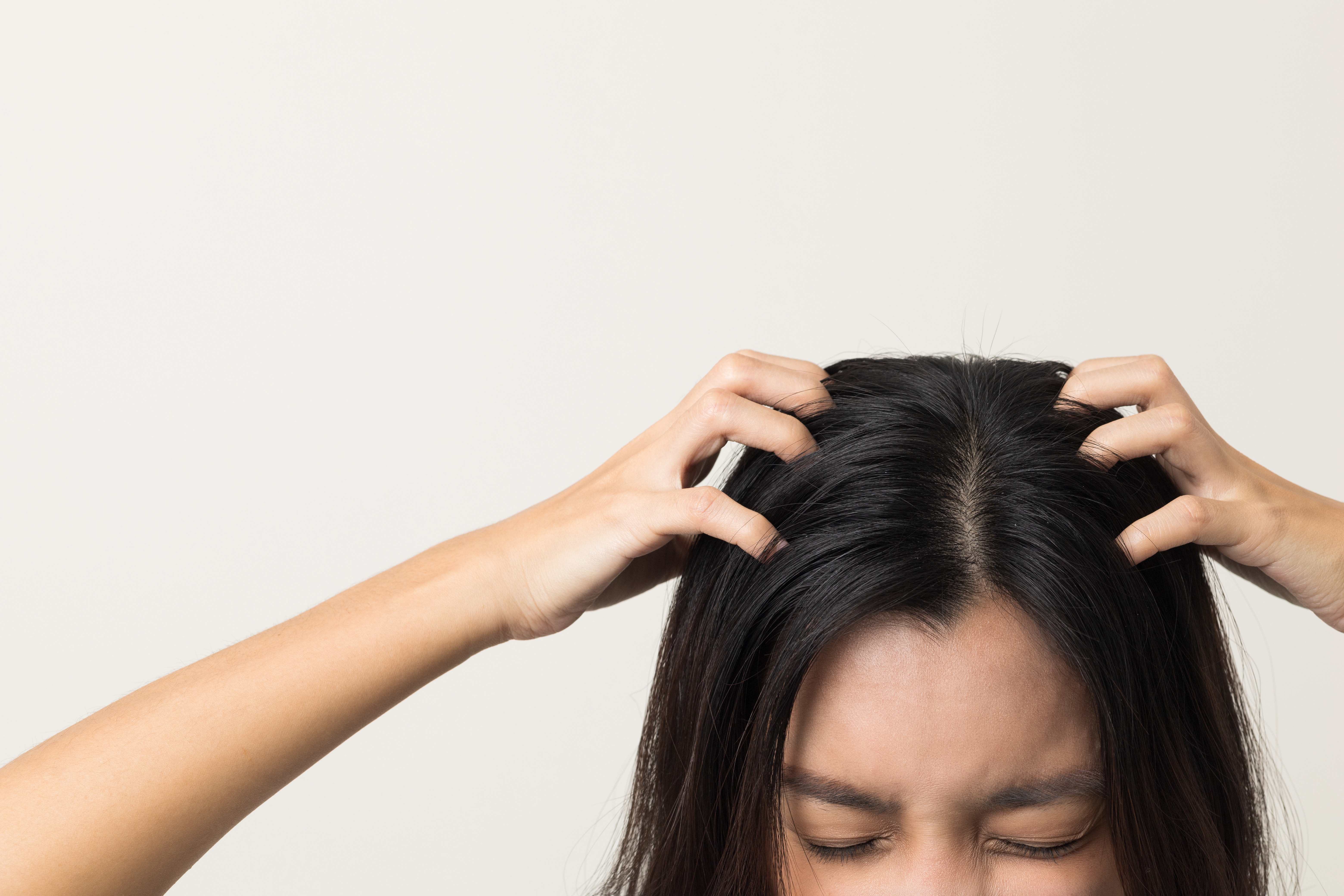 14 Best Itchy Scalp Home Remedies And 4 Ways to Prevent It  Kama Ayurveda