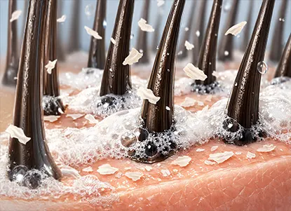 A clean, close-up visual of a healthy scalp and hair being gently cleansed, showing the removal of flakes and buildup to represent scalp exfoliation and a dandruff-free scalp