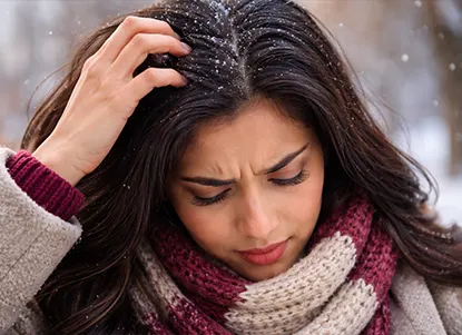 A winter-themed scene (scarves, cold air) with a person touching their scalp, indicating dryness and flakes caused by cold weather.