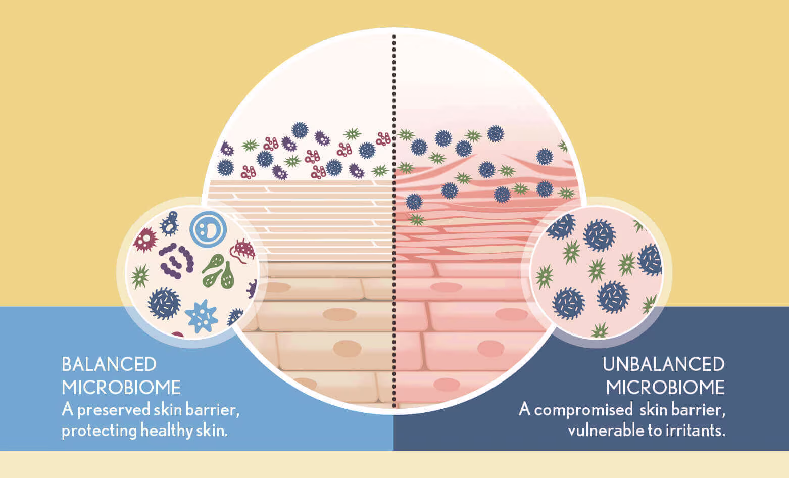 microbiome
