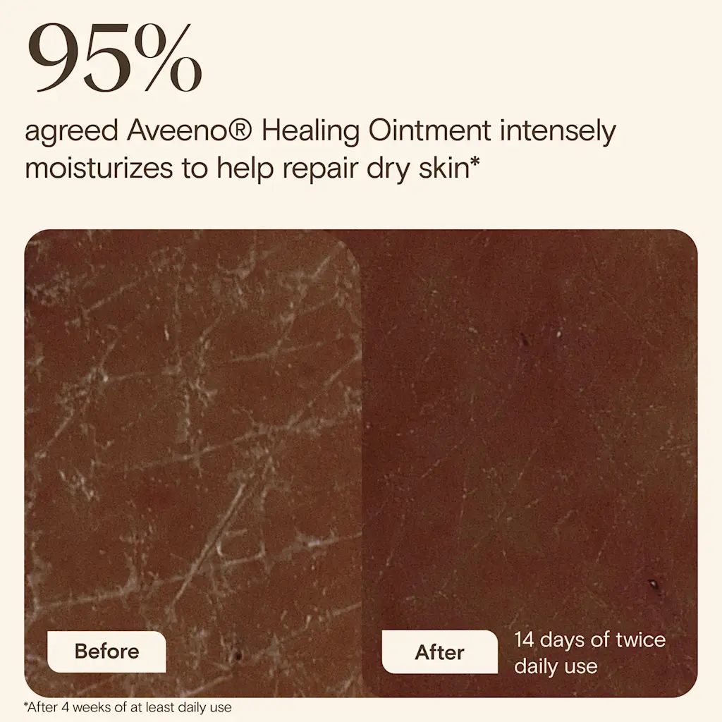 JS 4737 AVE Healing Ointment Enhanced Content EC Image Adaptation 3000x3000 FRE-F-06 (1)