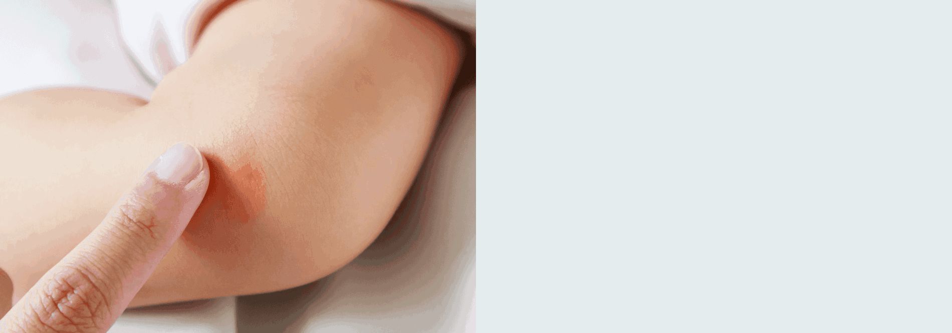 concern_-_dry_baby_skin_0-en-au