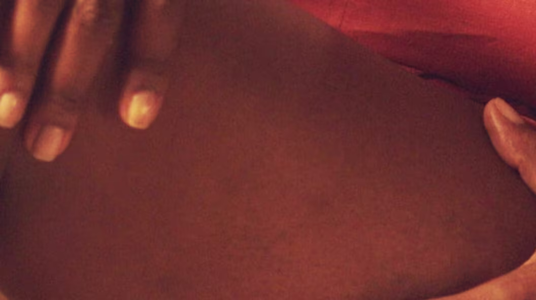 Uneven Tone and Texture Skin