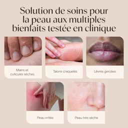 JS 4737 AVE Healing Ointment Enhanced Content EC Image Adaptation 600x449 FRE-F-02