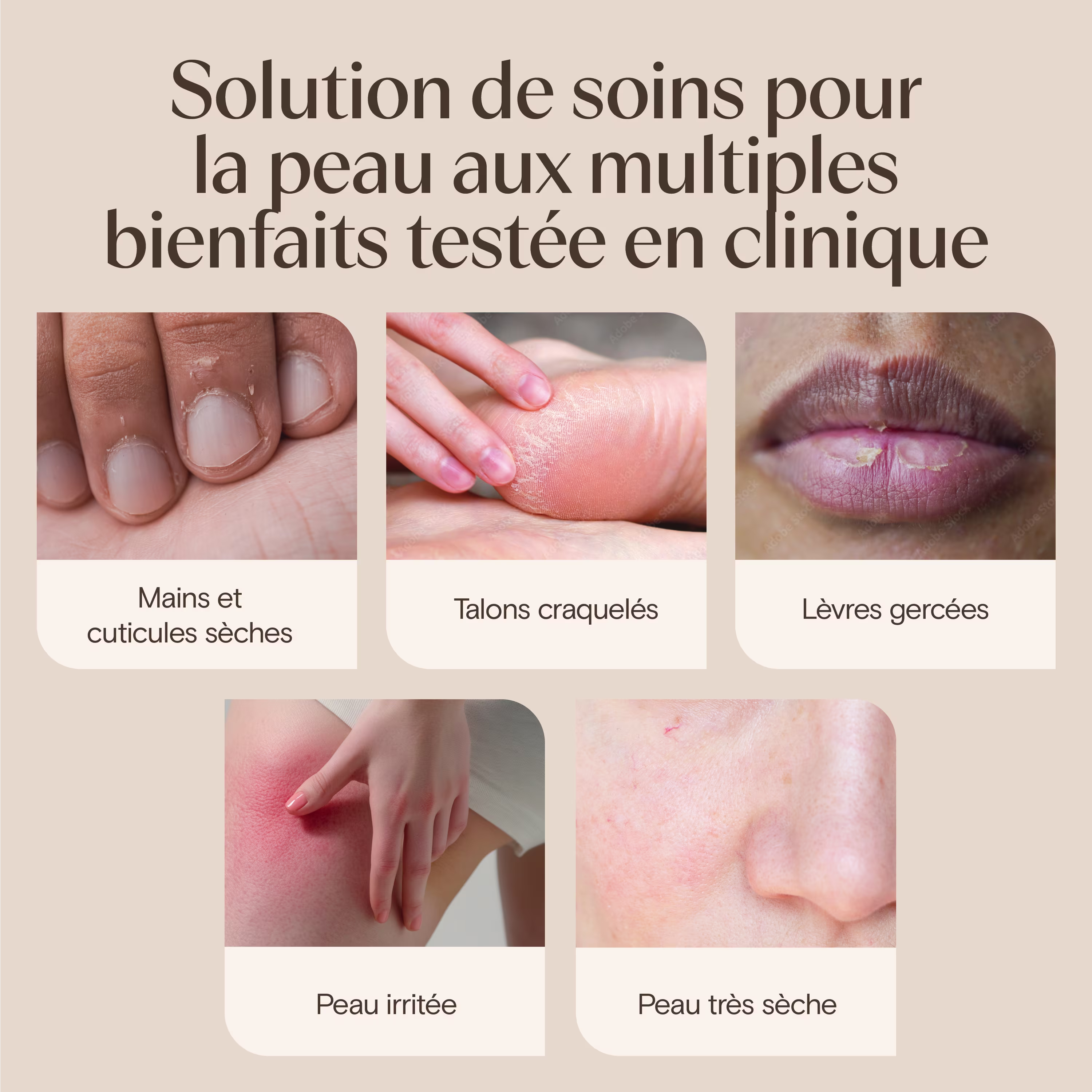 JS 4737 AVE Healing Ointment Enhanced Content EC Image Adaptation 600x449 FRE-F-02