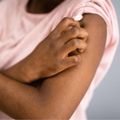Eczema Prone Skin