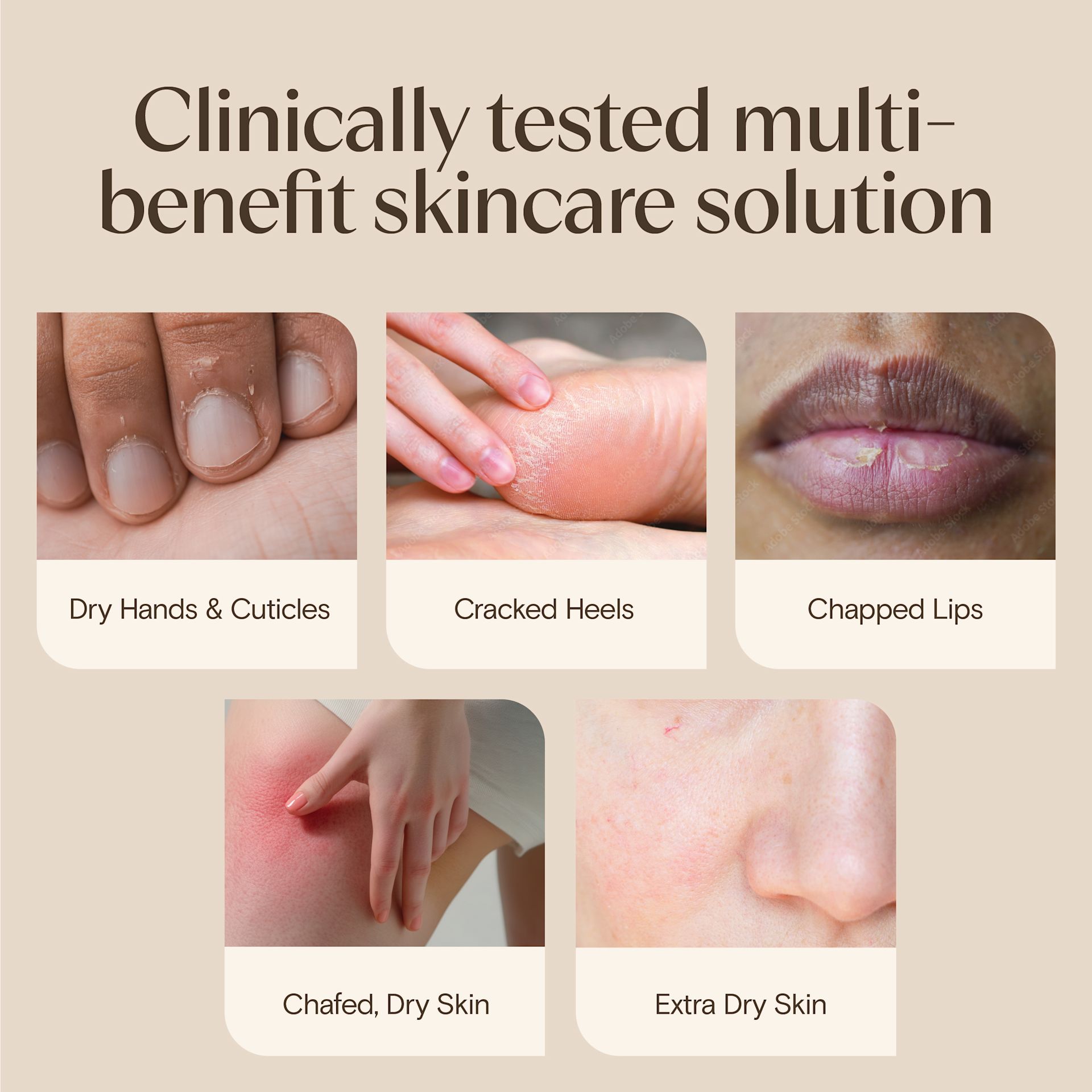 JS 4737 AVE Healing Ointment Enhanced Content EC Image Adaptation 600x449 ENG-F-02
