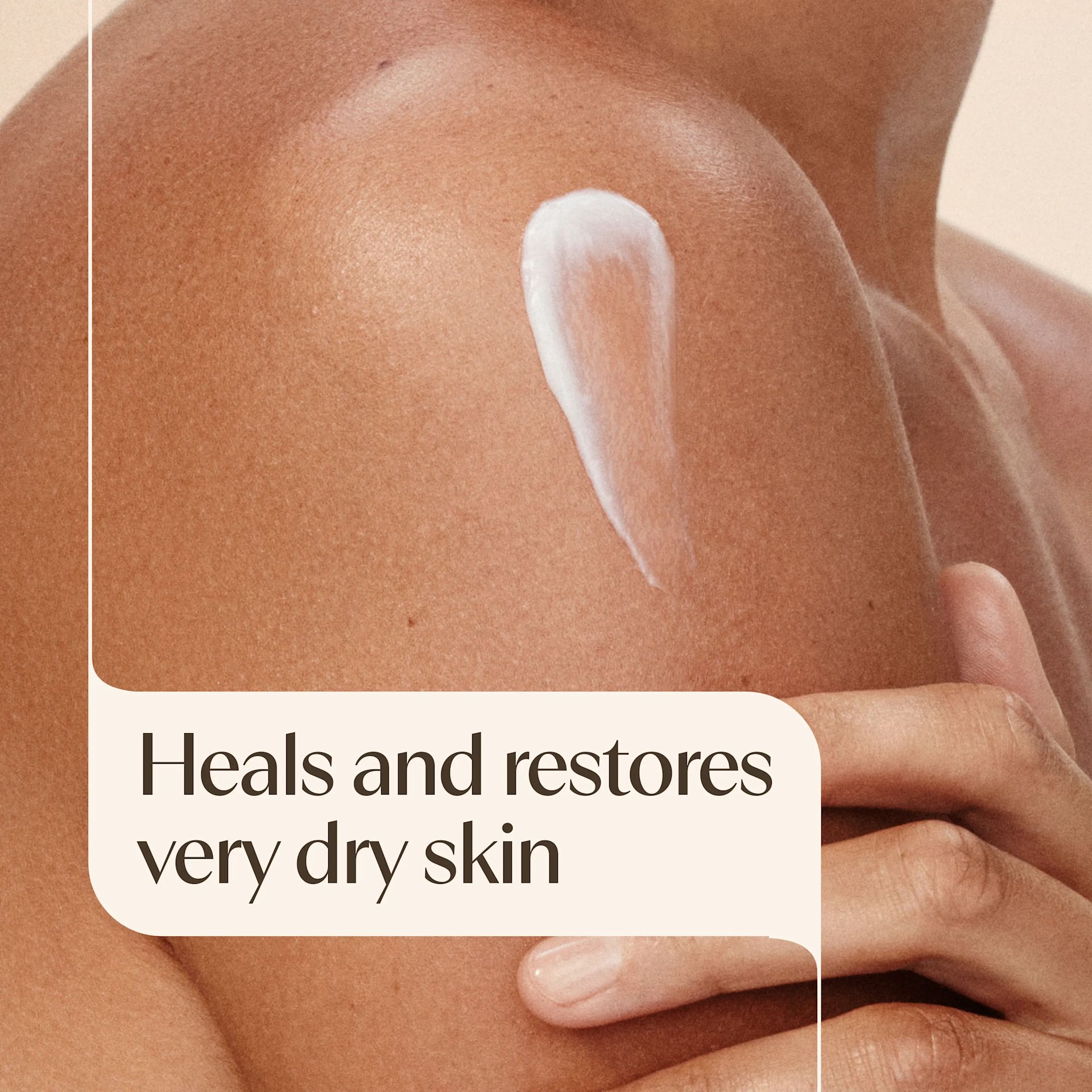Aveeno® Skin Relief Moisture Repair Cream heals and restores very dry skin