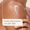 Aveeno® Skin Relief Moisture Repair Cream heals and restores very dry skin