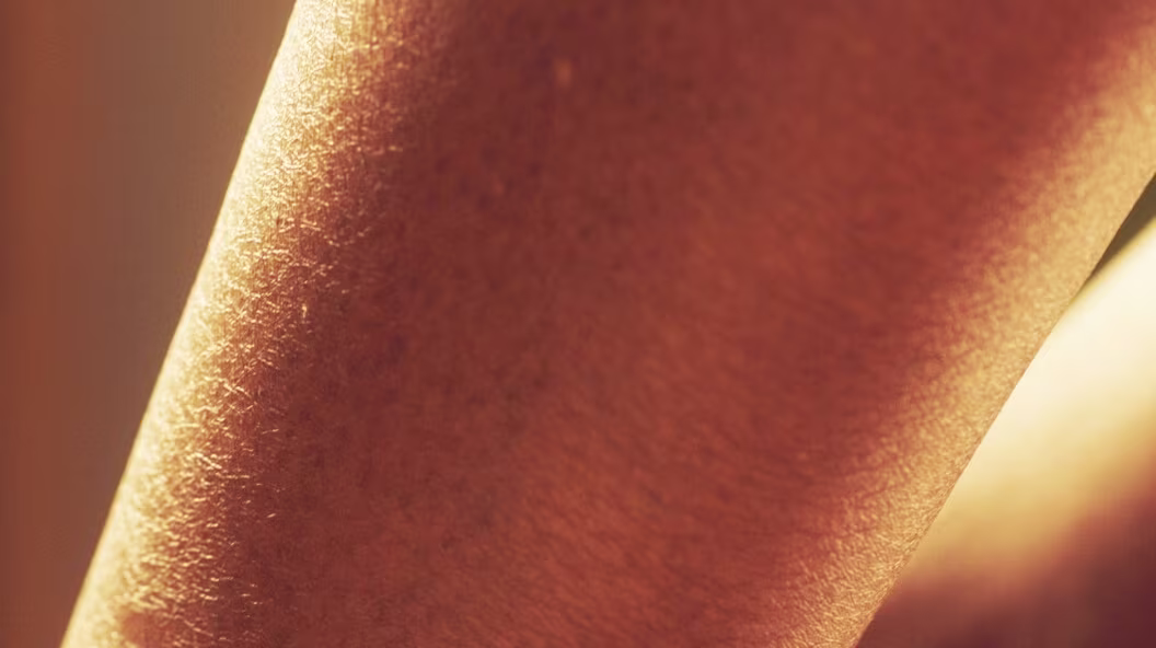 Uneven Tone and Texture Skin