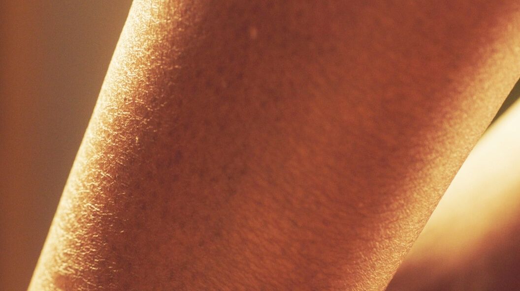 Uneven Tone and Texture Skin
