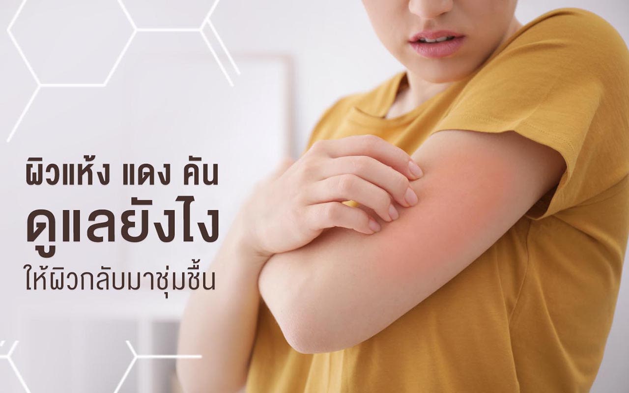 https://www.aveeno.co.th/sites/aveeno_th_2/files/phiwaehng_aedng_khan_duuaelyangaingaihphiwklabmaachumchuuen_sukhphaaphdii_cover.jpg