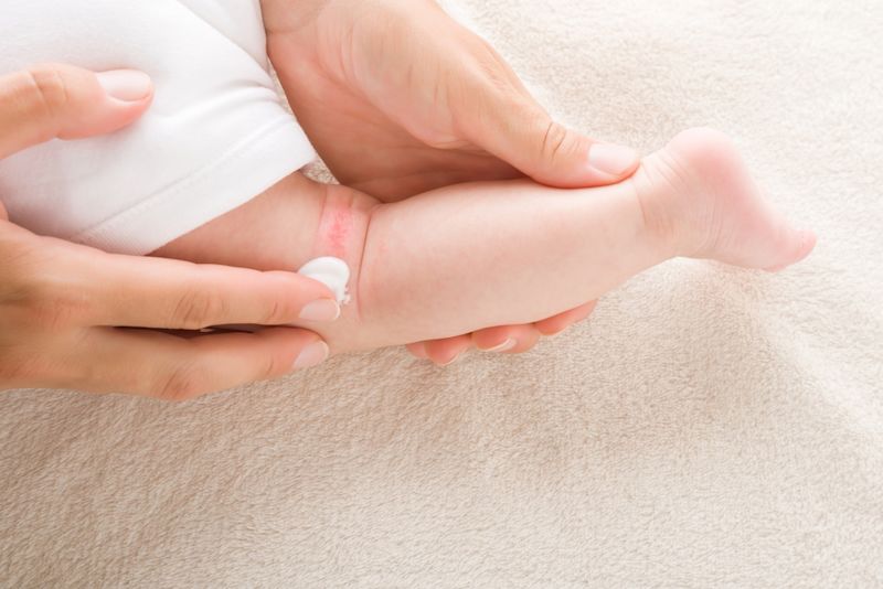 Atasi Semua Jenis Masalah Kulit dengan Krim Bayi: Iritasi, Ruam, atau Kulit Kering! - Hero Image